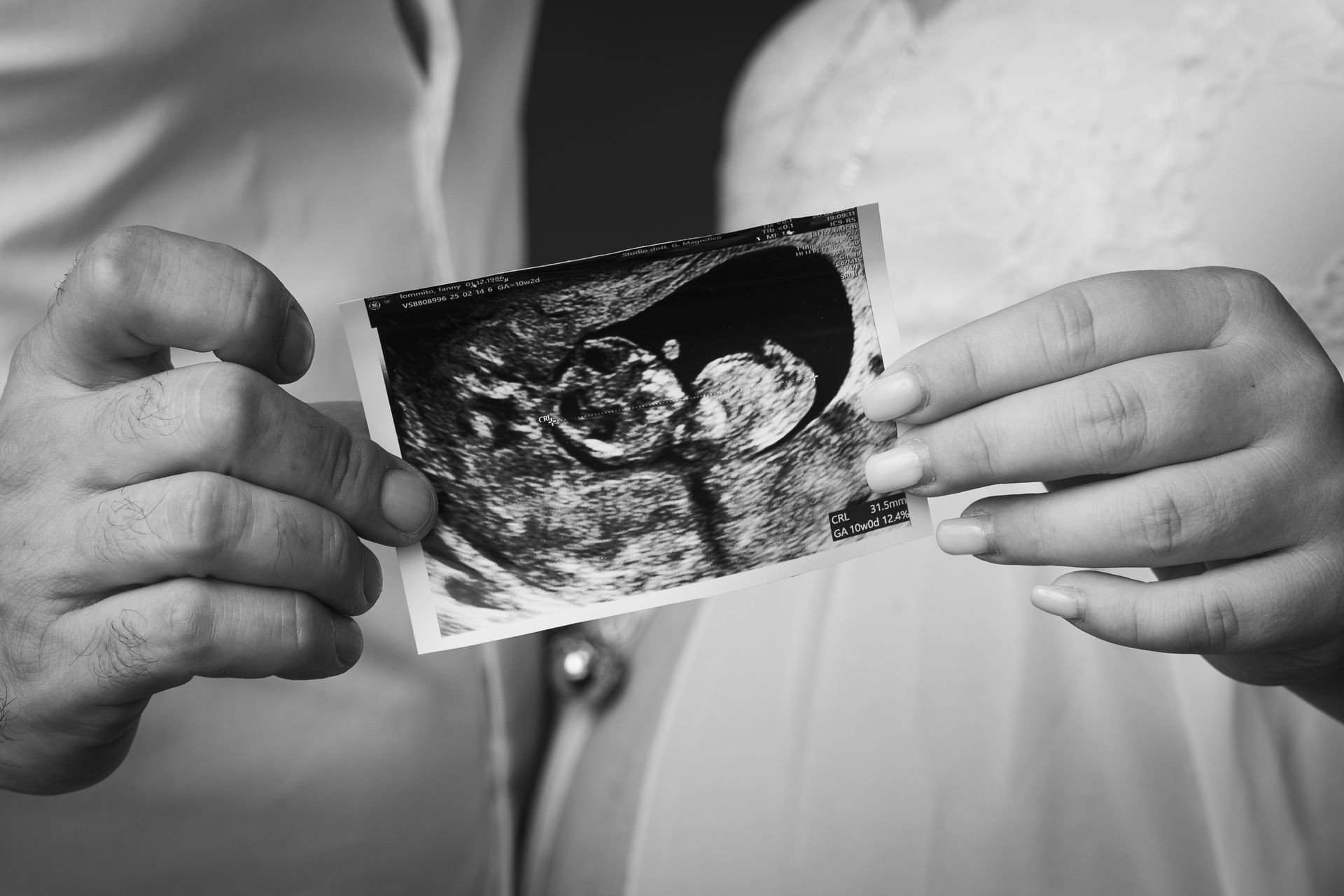 Quattro mani reggono insieme l'ecografia, in monocromia